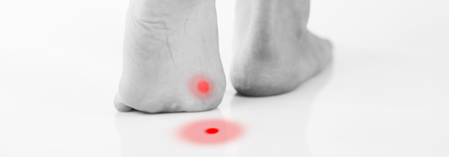 cryotherapy chippenham